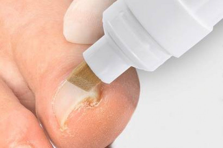 Stylo Aktivator B/S - Préparation de l'ongle